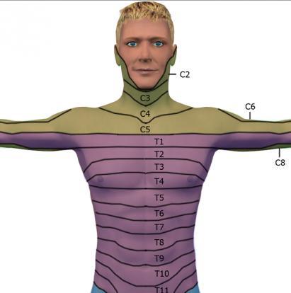 Shingles Dermatomal Pattern